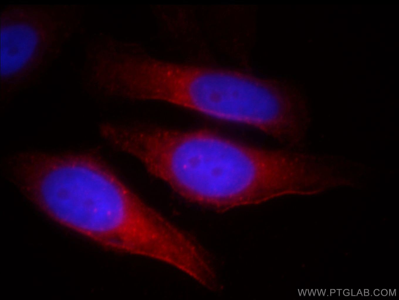 Immunofluorescence (IF) / fluorescent staining of HepG2 cells using TNKS Polyclonal antibody (18030-1-AP)