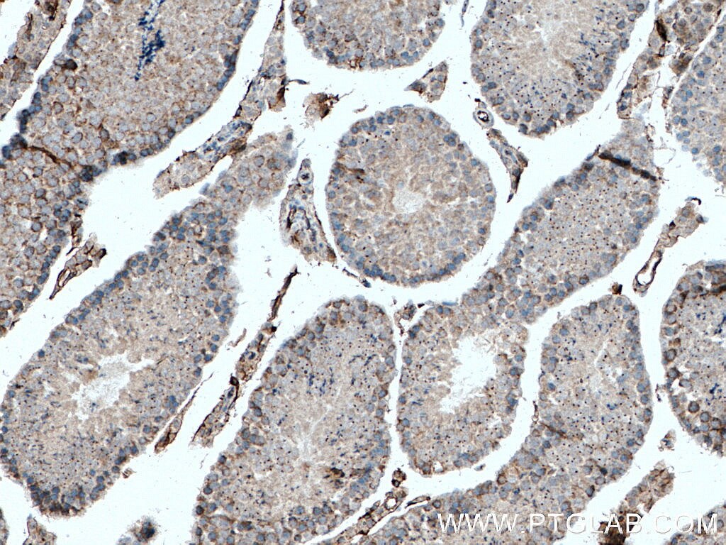 Immunohistochemistry (IHC) staining of mouse testis tissue using TNKS Polyclonal antibody (18030-1-AP)