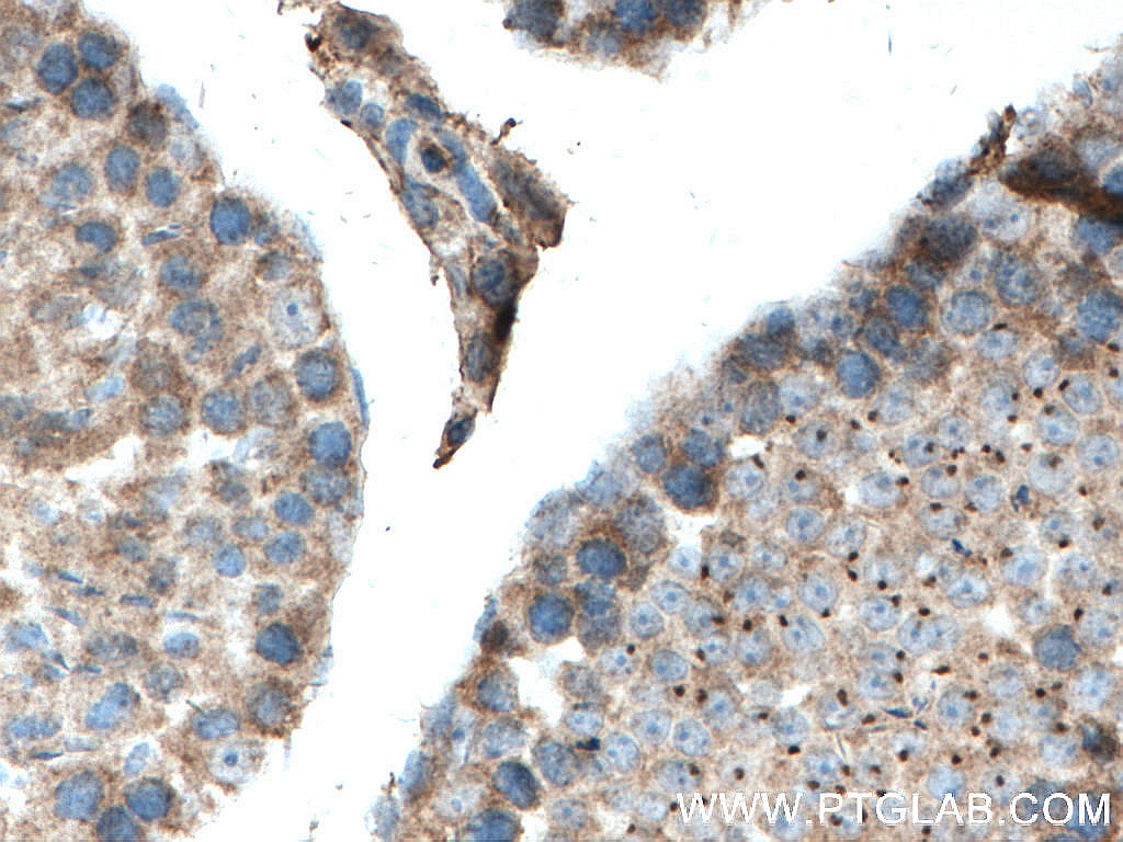 Immunohistochemistry (IHC) staining of mouse testis tissue using TNKS Polyclonal antibody (18030-1-AP)