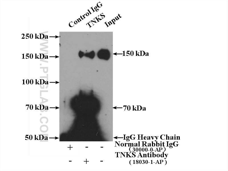 Immunoprecipitation (IP) experiment of Jurkat cells using TNKS Polyclonal antibody (18030-1-AP)