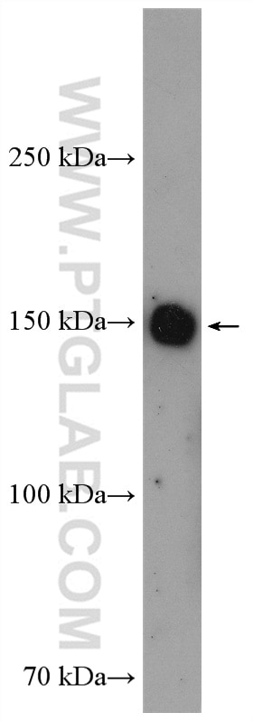 Western Blot (WB) analysis of HeLa cells using TNKS Polyclonal antibody (18030-1-AP)