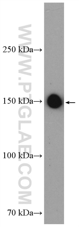 Western Blot (WB) analysis of MCF-7 cells using TNKS Polyclonal antibody (18030-1-AP)