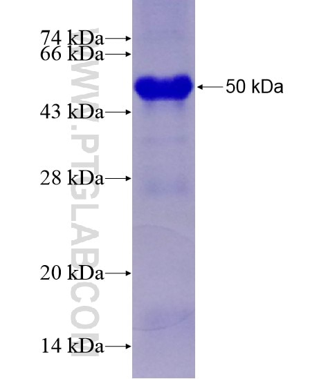 TNKS fusion protein Ag28838 SDS-PAGE