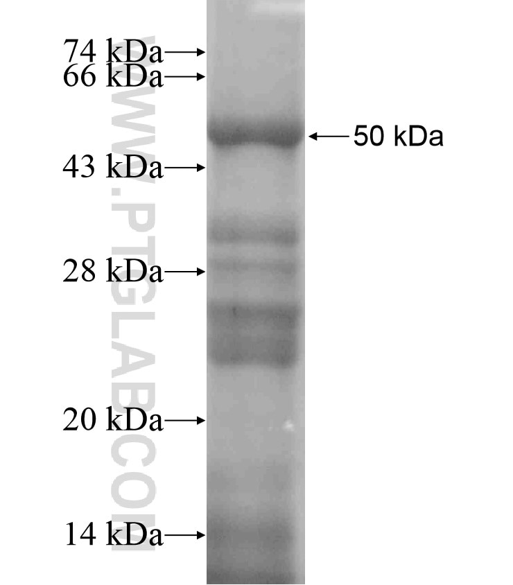 TNMD fusion protein Ag18291 SDS-PAGE