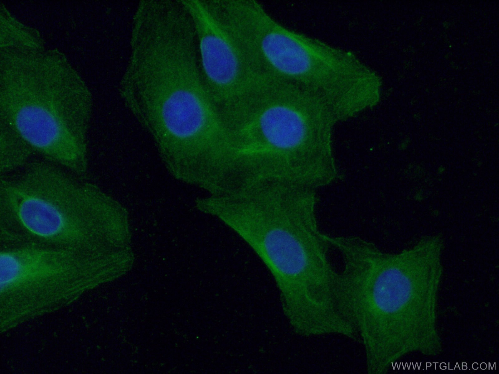 Immunofluorescence (IF) / fluorescent staining of U2OS cells using TNNC1 Polyclonal antibody (13504-1-AP)