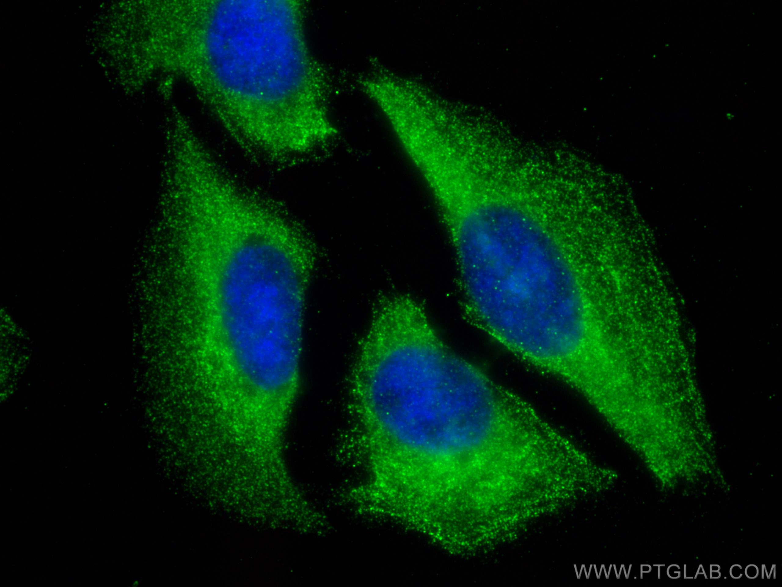Immunofluorescence (IF) / fluorescent staining of U2OS cells using TNNC1 Polyclonal antibody (13504-1-AP)