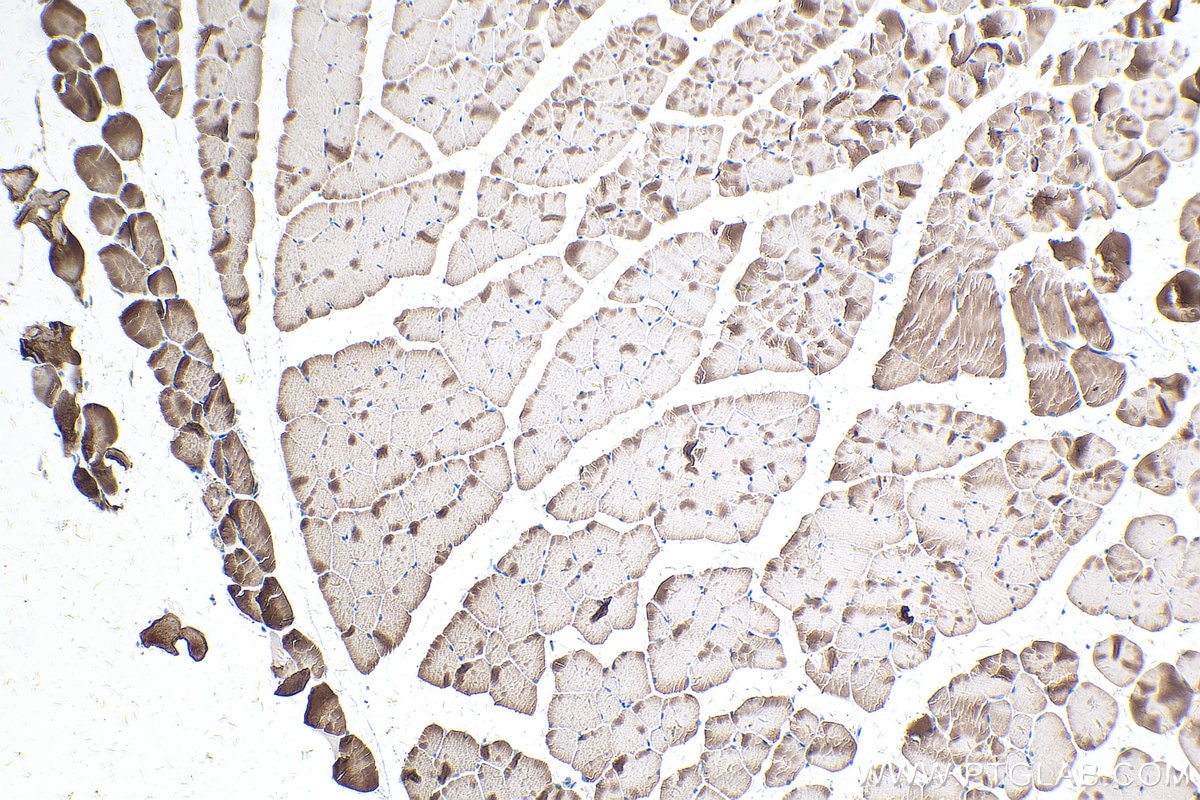Immunohistochemistry (IHC) staining of mouse skeletal muscle tissue using TNNC1 Polyclonal antibody (13504-1-AP)