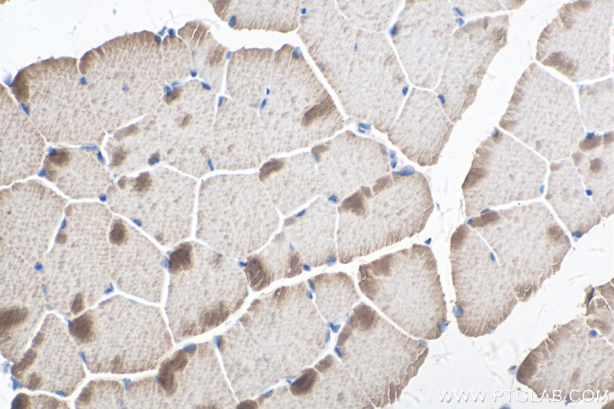 Immunohistochemistry (IHC) staining of mouse skeletal muscle tissue using TNNC1 Polyclonal antibody (13504-1-AP)