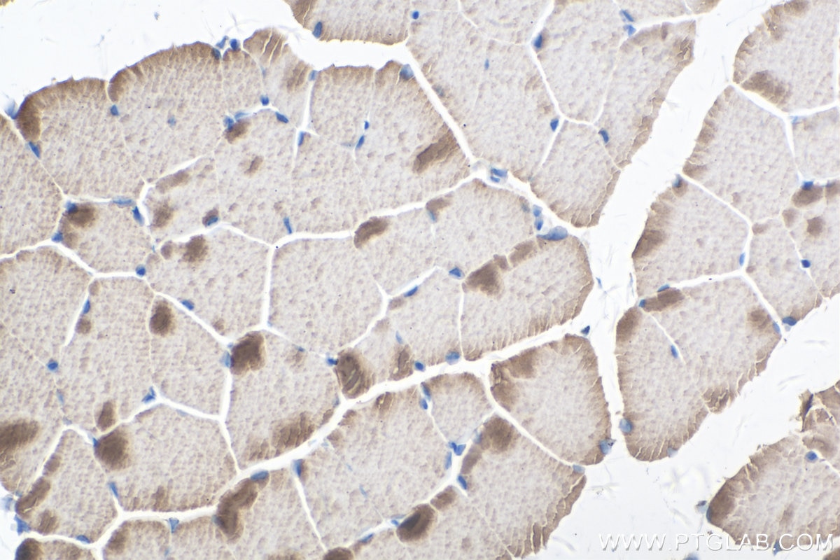 Immunohistochemistry (IHC) staining of mouse skeletal muscle tissue using TNNC1 Polyclonal antibody (13504-1-AP)