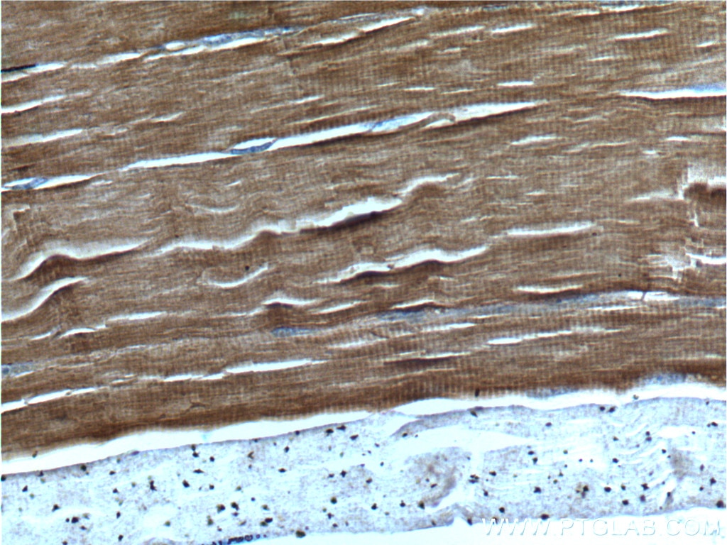 Immunohistochemistry (IHC) staining of human skeletal muscle tissue using TNNC1 Polyclonal antibody (13504-1-AP)