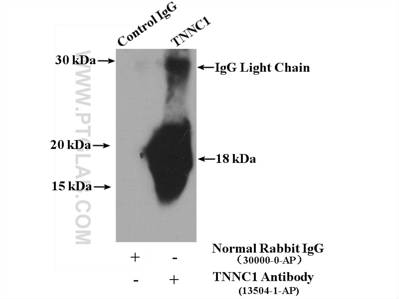 Immunoprecipitation (IP) experiment of mouse heart tissue using TNNC1 Polyclonal antibody (13504-1-AP)