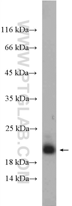 Western Blot (WB) analysis of mouse skeletal muscle tissue using TNNC1 Polyclonal antibody (13504-1-AP)