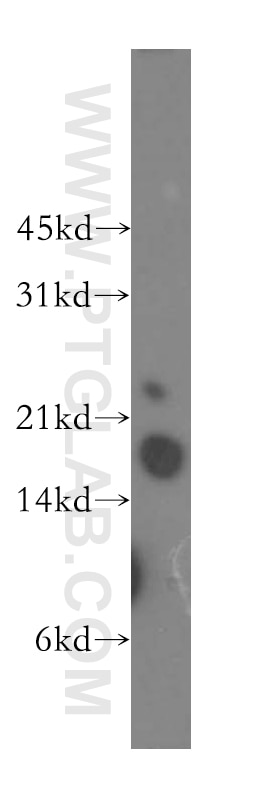 Western Blot (WB) analysis of human stomach tissue using TNNC1 Polyclonal antibody (13504-1-AP)