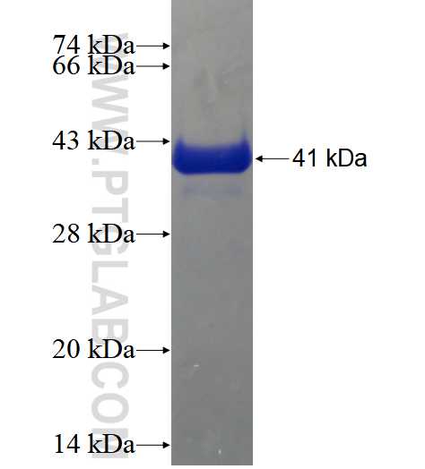 TNNC1 fusion protein Ag4339 SDS-PAGE
