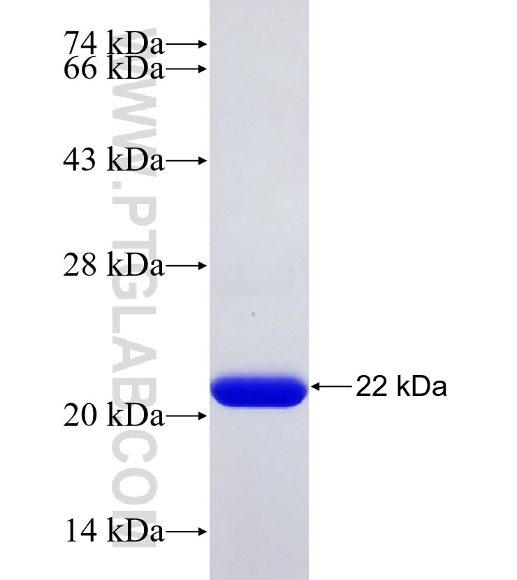 TNNC1 fusion protein Ag6849 SDS-PAGE