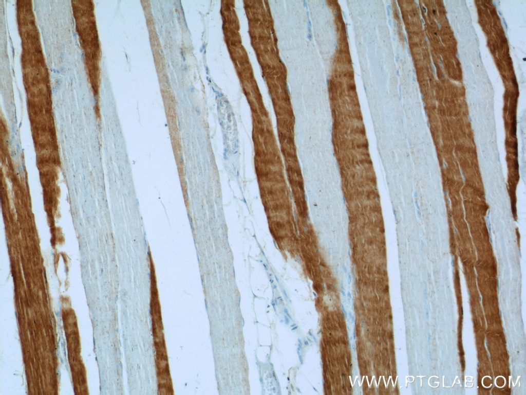 IHC staining of human skeletal muscle using 15875-1-AP