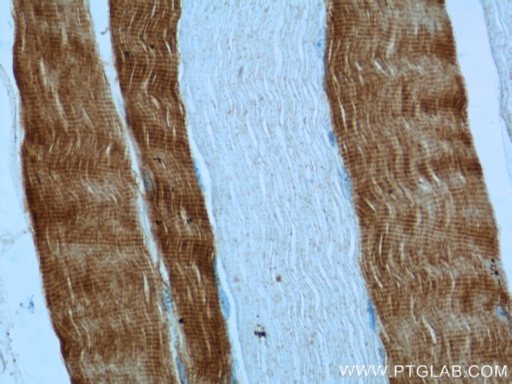 Immunohistochemistry (IHC) staining of human skeletal muscle tissue using TNNC2 Polyclonal antibody (15875-1-AP)