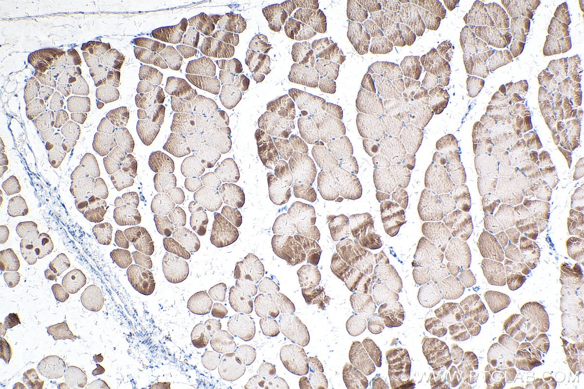 Immunohistochemistry (IHC) staining of mouse skeletal muscle tissue using TNNC2 Polyclonal antibody (15875-1-AP)
