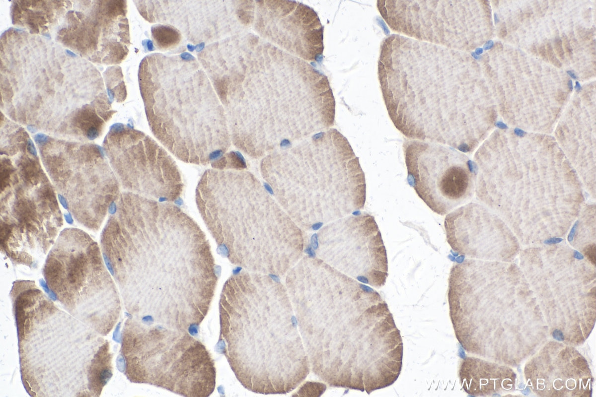 Immunohistochemistry (IHC) staining of mouse skeletal muscle tissue using TNNC2 Polyclonal antibody (15875-1-AP)