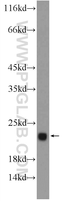 Western Blot (WB) analysis of rat skeletal muscle tissue using TNNC2 Polyclonal antibody (15875-1-AP)