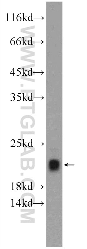 Western Blot (WB) analysis of mouse skeletal muscle tissue using TNNC2 Polyclonal antibody (15875-1-AP)