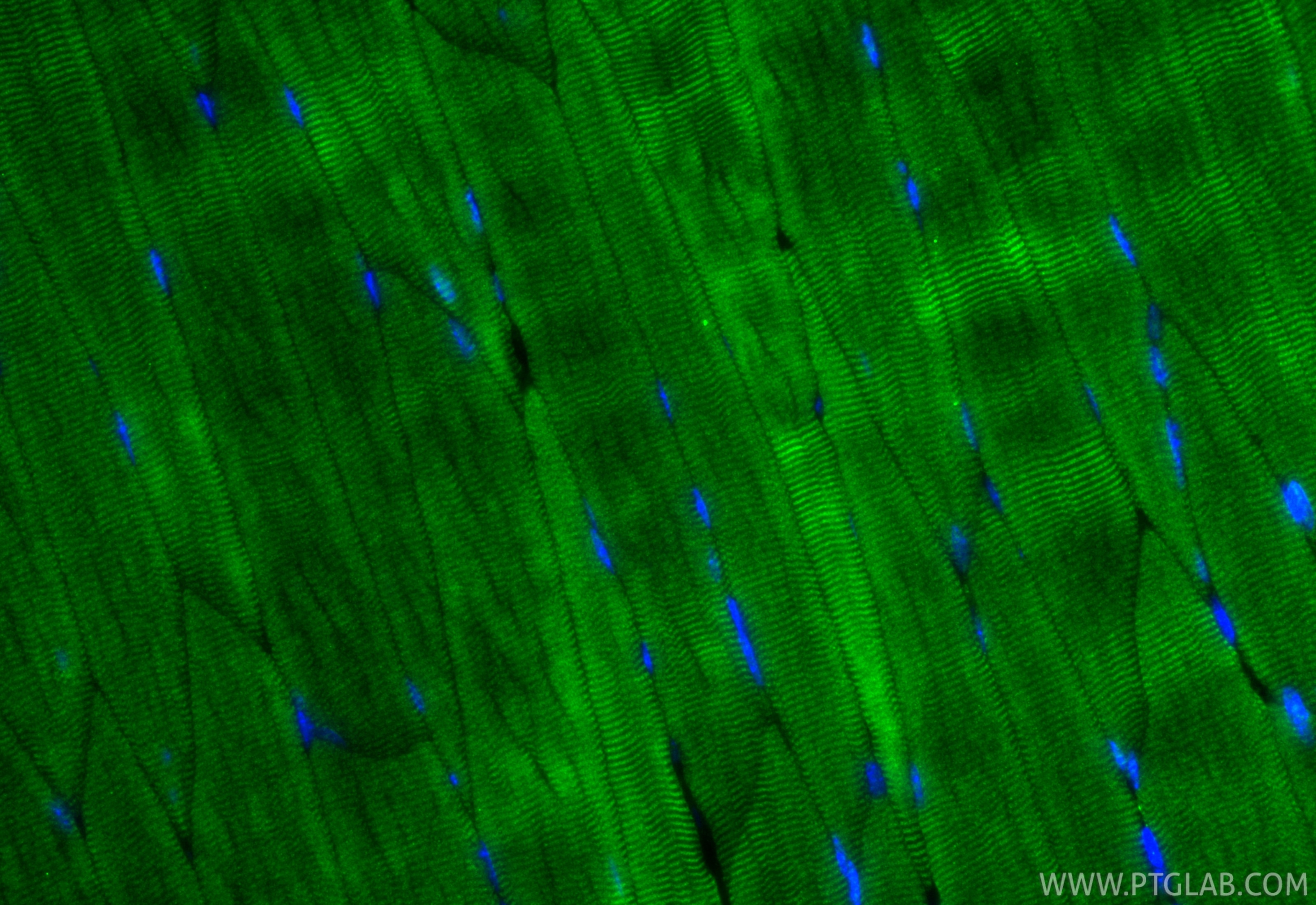 Immunofluorescence (IF) / fluorescent staining of mouse skeletal muscle tissue using TNNI1 Polyclonal antibody (16102-1-AP)