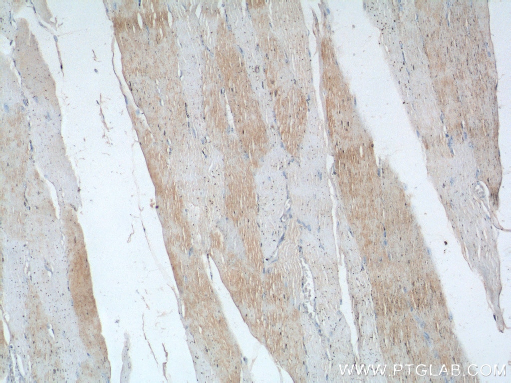 Immunohistochemistry (IHC) staining of human skeletal muscle tissue using TNNI1 Polyclonal antibody (16102-1-AP)