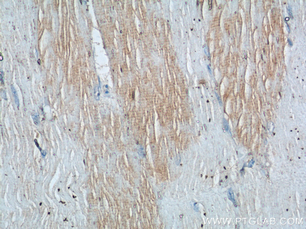 Immunohistochemistry (IHC) staining of human skeletal muscle tissue using TNNI1 Polyclonal antibody (16102-1-AP)