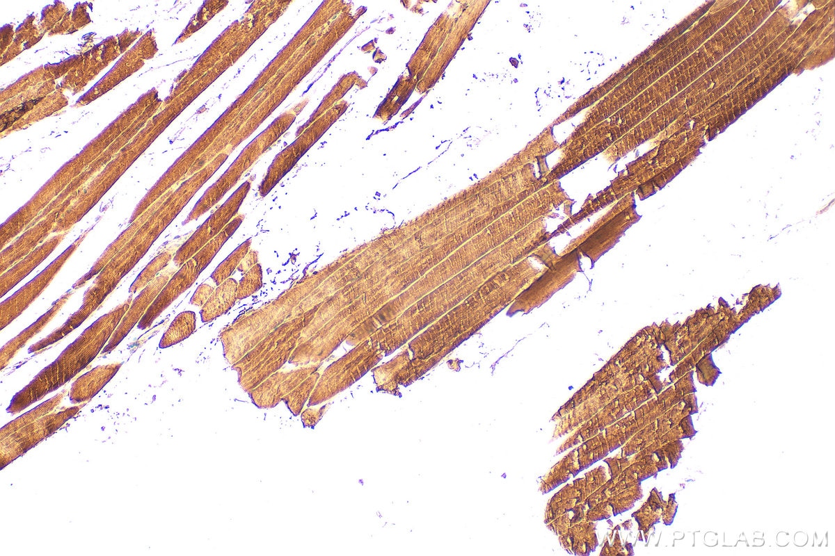 Immunohistochemistry (IHC) staining of mouse skeletal muscle tissue using TNNI1 Polyclonal antibody (16102-1-AP)