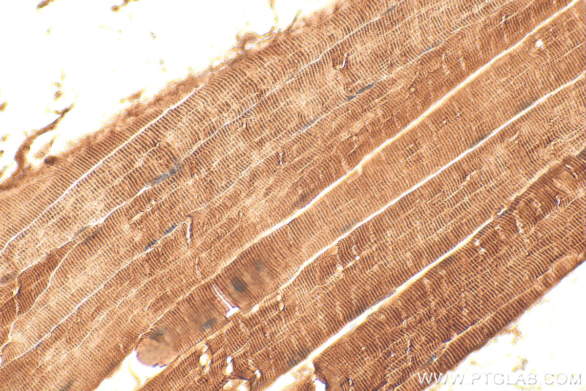 Immunohistochemistry (IHC) staining of mouse skeletal muscle tissue using TNNI1 Polyclonal antibody (16102-1-AP)