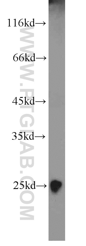 Western Blot (WB) analysis of human skeletal muscle tissue using TNNI1 Polyclonal antibody (16102-1-AP)