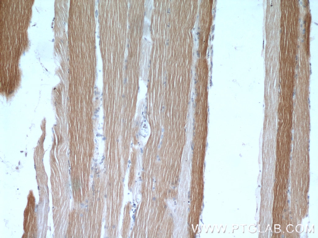 IHC staining of human skeletal muscle using 22253-1-AP
