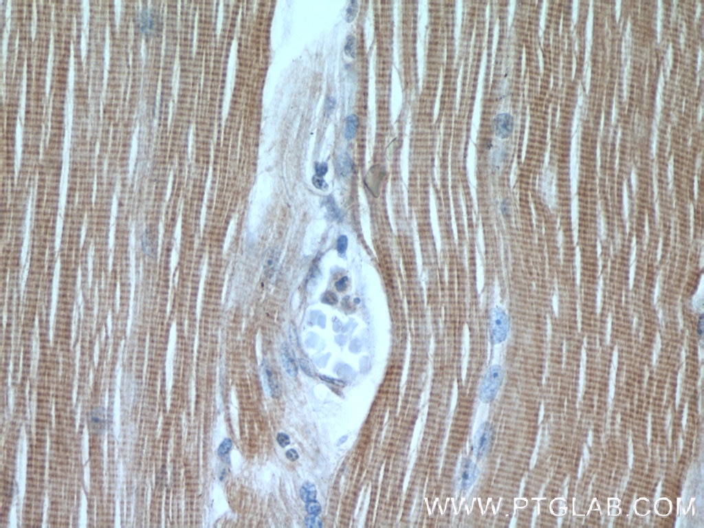 Immunohistochemistry (IHC) staining of human skeletal muscle tissue using TNNI1 Polyclonal antibody (22253-1-AP)