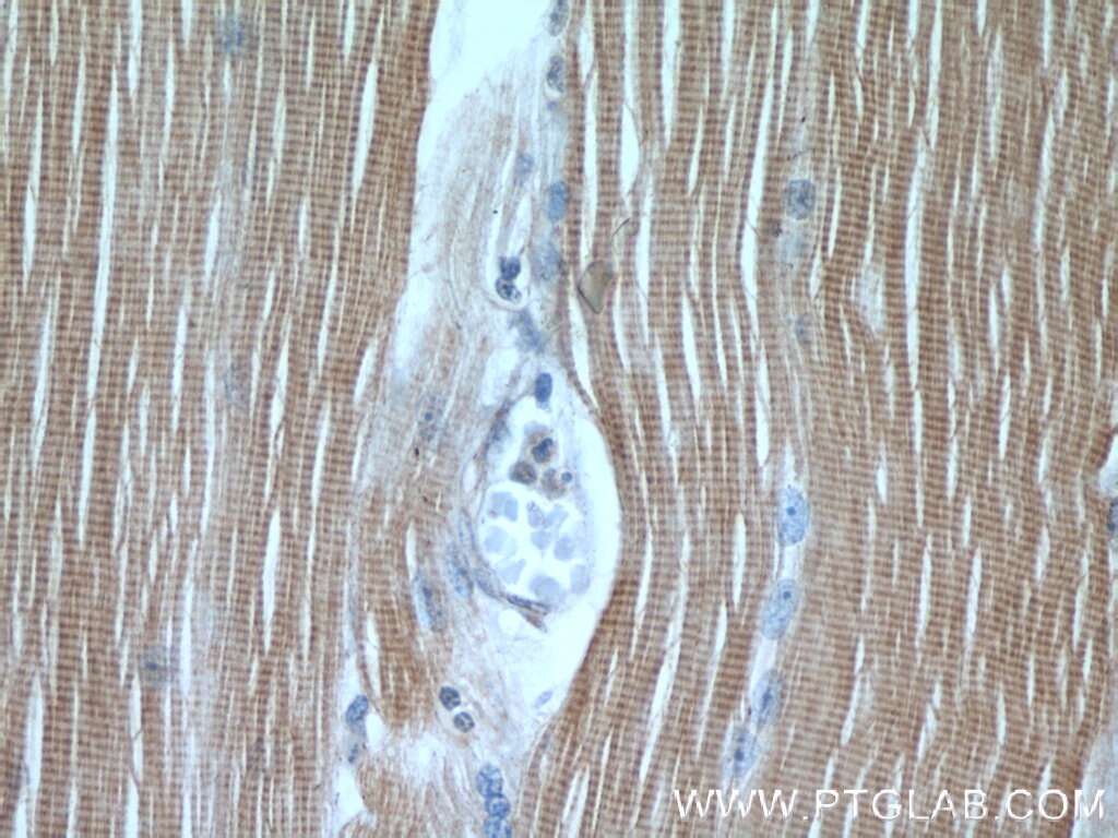 Immunohistochemistry (IHC) staining of human skeletal muscle tissue using TNNI1 Polyclonal antibody (22253-1-AP)