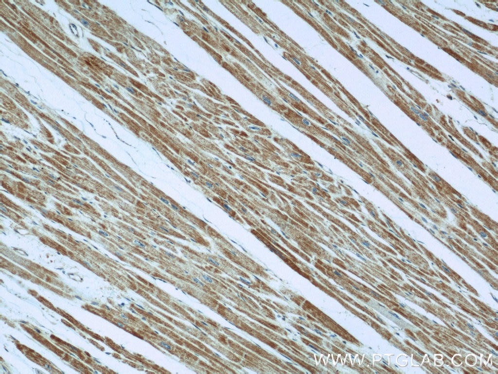 IHC staining of human heart using 22253-1-AP