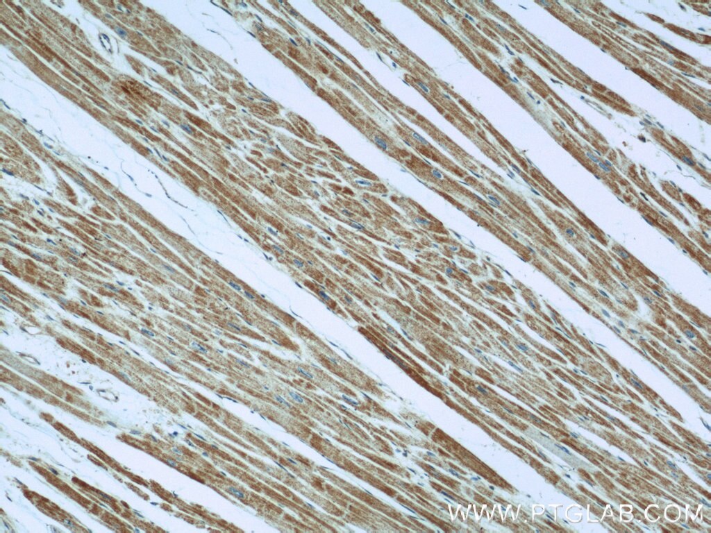 Immunohistochemistry (IHC) staining of human heart tissue using TNNI1 Polyclonal antibody (22253-1-AP)