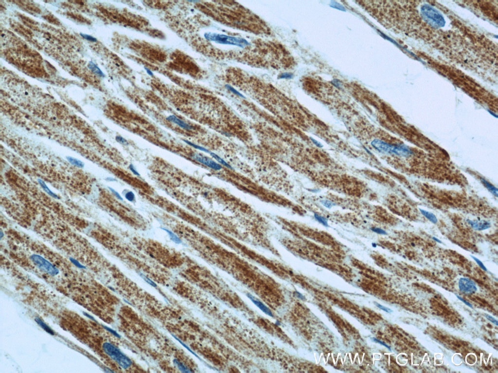 IHC staining of human heart using 22253-1-AP