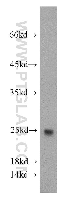 TNNI1