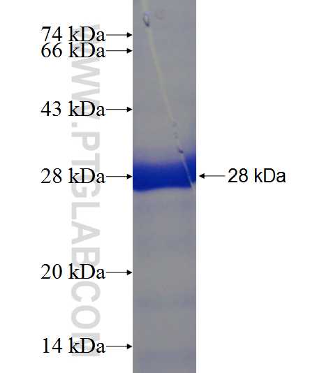 TNNI1 fusion protein Ag8983 SDS-PAGE