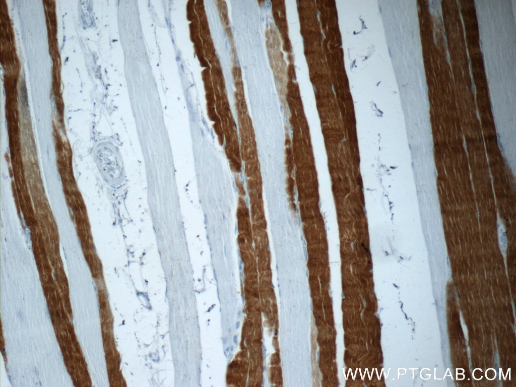 Immunohistochemistry (IHC) staining of human skeletal muscle tissue using TNNI2 Polyclonal antibody (11634-1-AP)