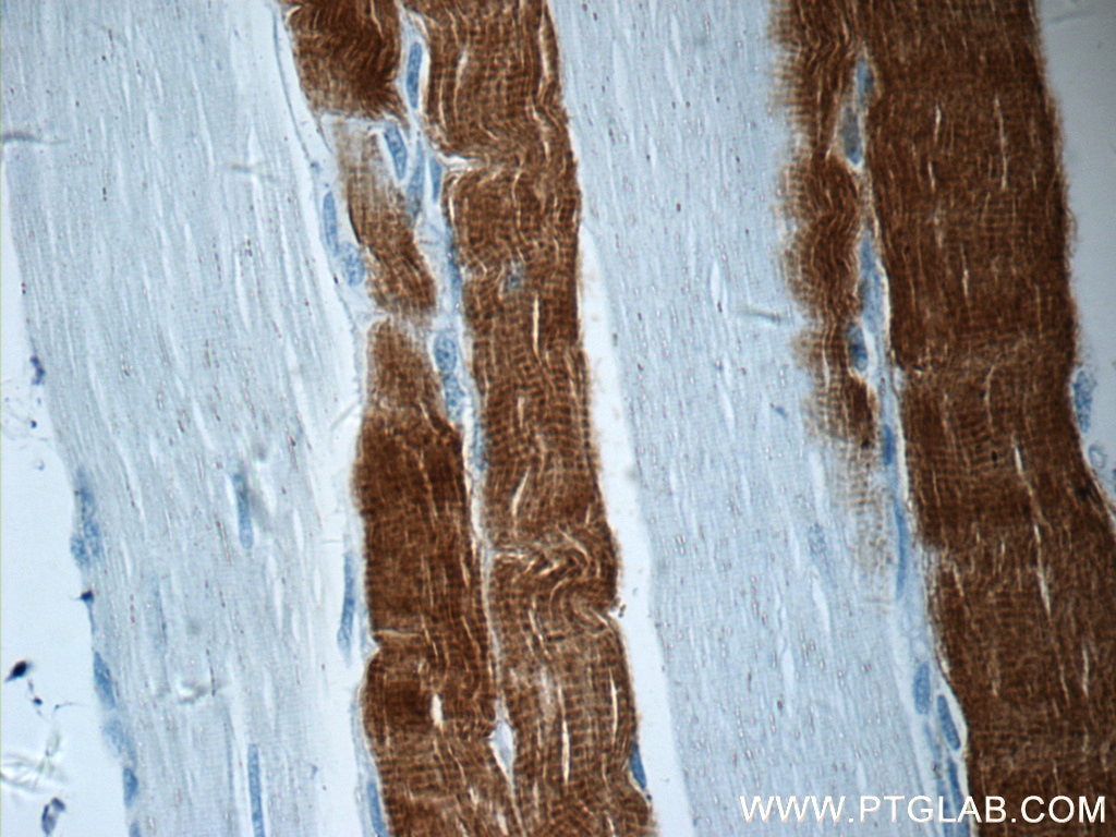 Immunohistochemistry (IHC) staining of human skeletal muscle tissue using TNNI2 Polyclonal antibody (11634-1-AP)