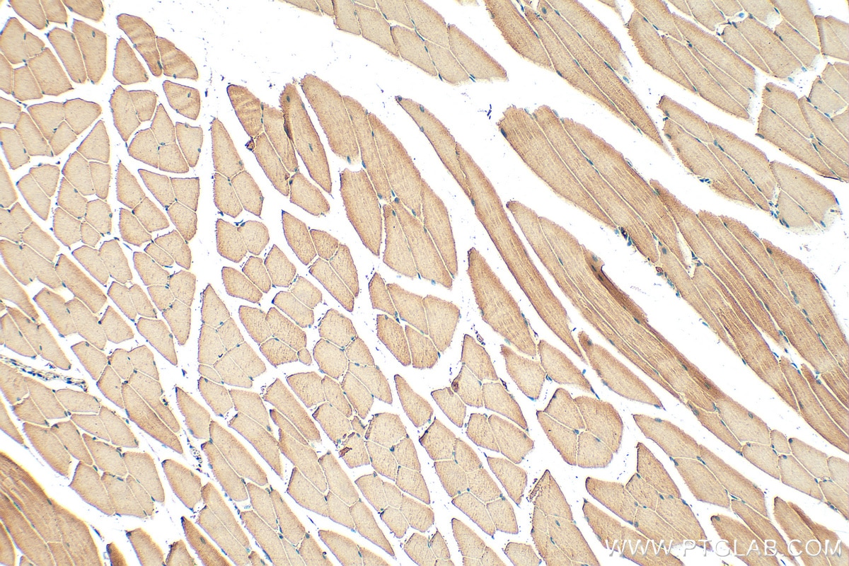 Immunohistochemistry (IHC) staining of mouse skeletal muscle tissue using TNNI2 Polyclonal antibody (11634-1-AP)