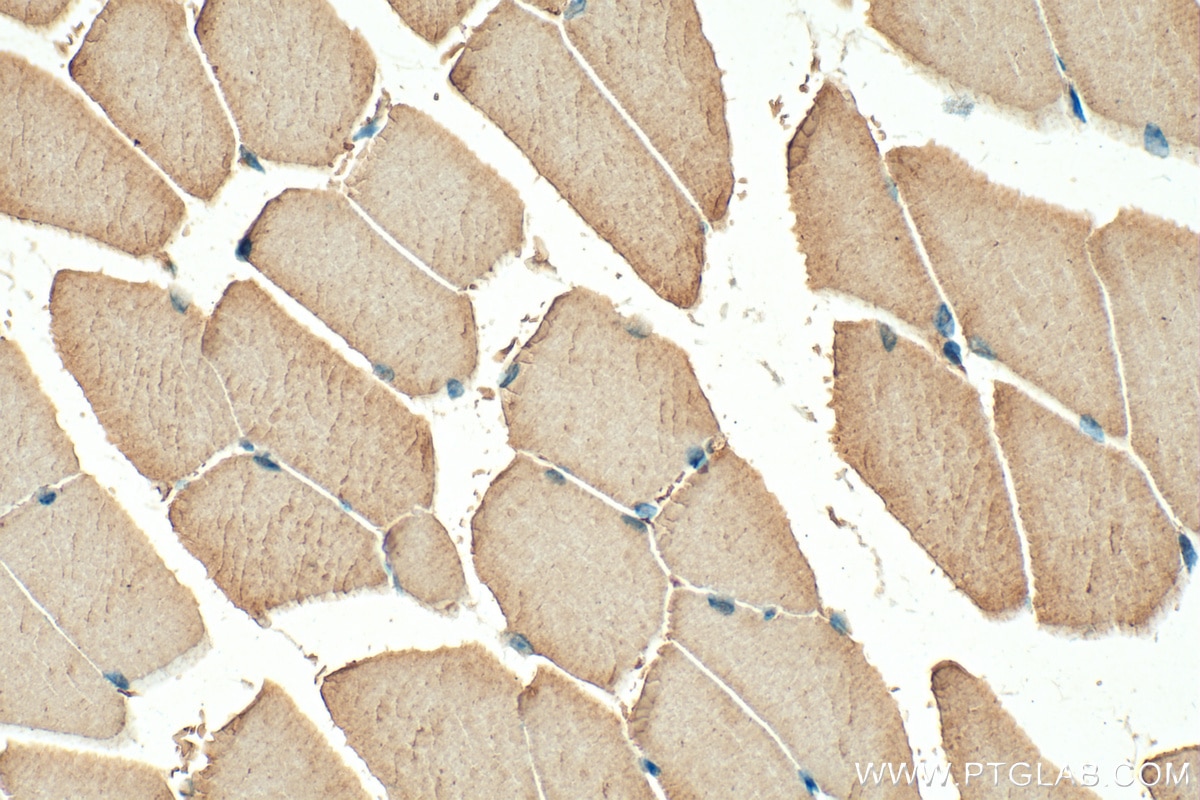 Immunohistochemistry (IHC) staining of mouse skeletal muscle tissue using TNNI2 Polyclonal antibody (11634-1-AP)