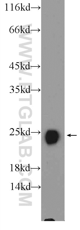 Western Blot (WB) analysis of mouse skeletal muscle tissue using TNNI2 Polyclonal antibody (11634-1-AP)