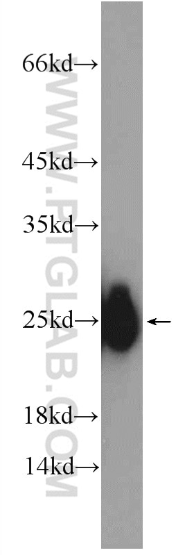 Western Blot (WB) analysis of rat skeletal muscle tissue using TNNI2 Polyclonal antibody (11634-1-AP)