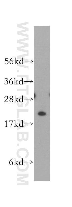 Western Blot (WB) analysis of human kidney tissue using TNNI2 Polyclonal antibody (11634-1-AP)
