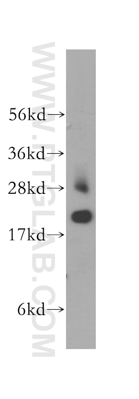 Western Blot (WB) analysis of human spleen tissue using TNNI2 Polyclonal antibody (11634-1-AP)