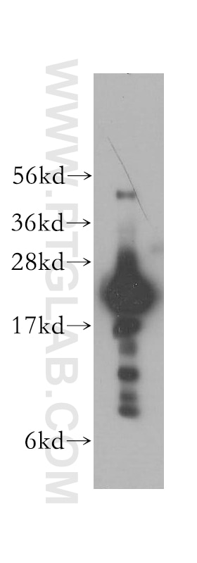 Western Blot (WB) analysis of human skeletal muscle tissue using TNNI2 Polyclonal antibody (11634-1-AP)
