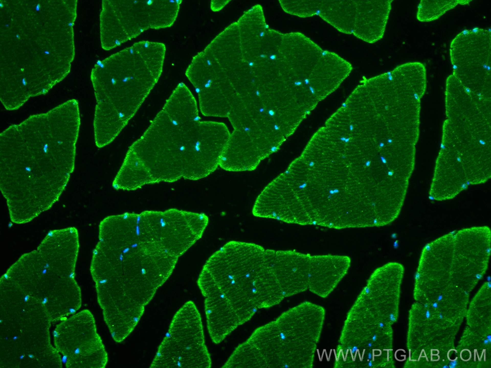 IF Staining of mouse skeletal muscle using 22130-1-AP