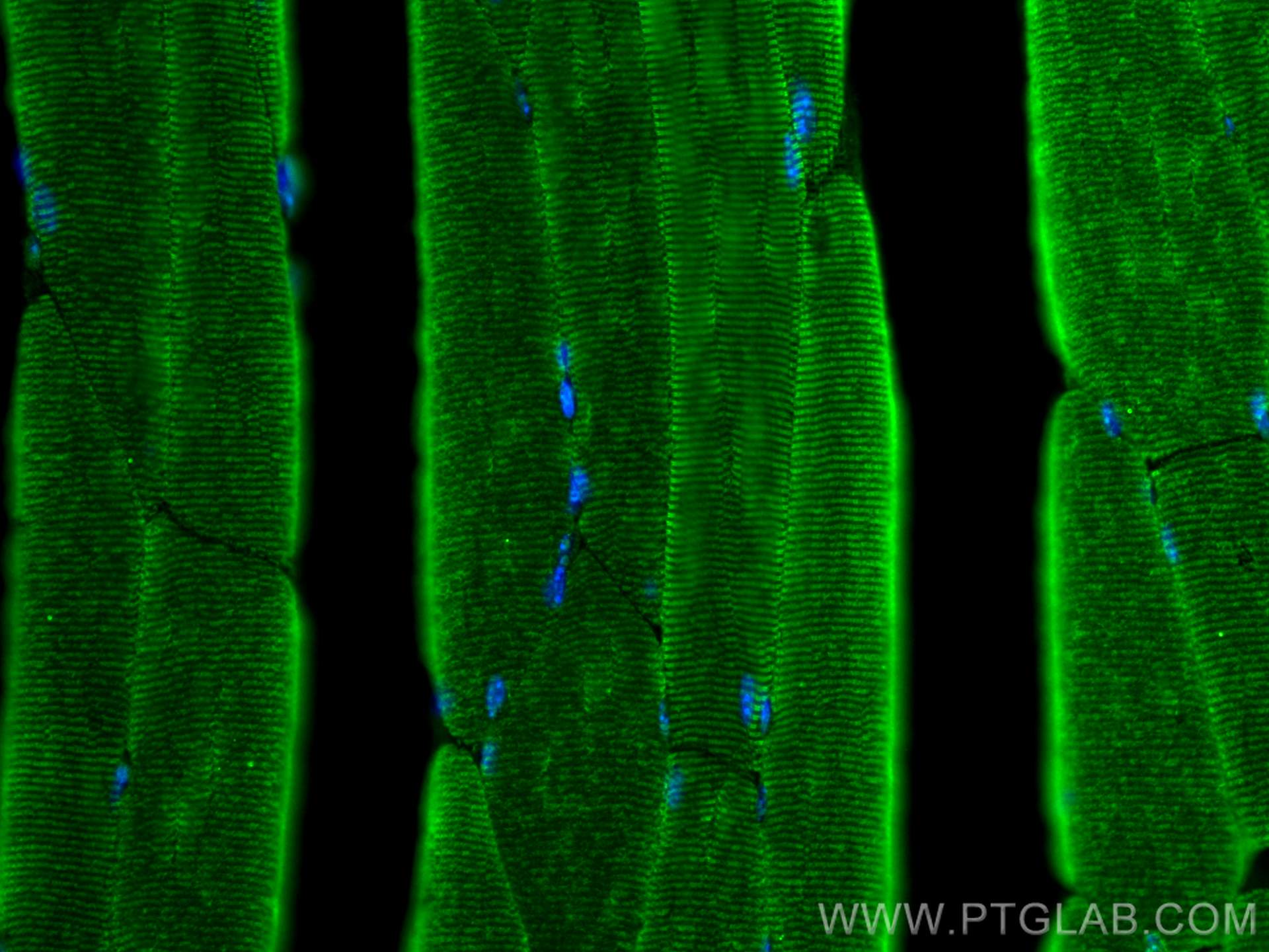 Immunofluorescence (IF) / fluorescent staining of mouse skeletal muscle tissue using TNNI2 Polyclonal antibody (22130-1-AP)